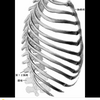 浮遊肋骨の痛み。。