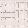 ECG-140：answer