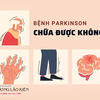 Bệnh Parkinson có chữa được không? Có khỏi hẳn được không?