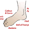 Home Cure For Foot Pain