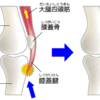 成長期のヒザの痛み。もしかしたらオスグッド病かも知れませんよ
