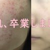 【画像】汚肌卒業！ニキビ改善に効果があったスキンケアまとめ