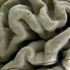 アルツハイマーを引き起こす遺伝子とは