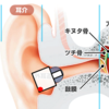 外耳道共鳴とイヤホン深浅