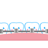 【歯列矯正】食事中はゴムかけしてはいけない！？【調整日記録】