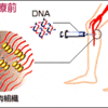 じじぃの「糖尿病・足首の壊疽・遺伝子治療の時代が始まる！TVシンポジウム」