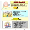 爪の付け根の毛細血管は詰まりやすい