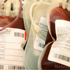 病院での殺人事件：Covid-19ワクチン汚染血液の術前輸血で新生児が「巨大な血栓」で死ぬ