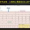 ECG-208：answer