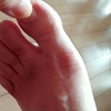 自宅でできる、足趾のモビリティ