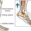 What Can Cause Achilles Tendinitis ?