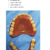 115回歯科医師国家試験【115C-88】術後管理編