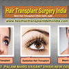Hair Transplant Surgery - Regain Hair Growth!