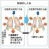 陥没呼吸のメカニズムとその重症度判定