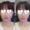 ④整形する時、先生との話し合いツールは何がいい？