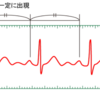 心電図におけるサイナス（洞調律）の定義