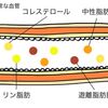 内科疾患を知りリスク管理！脂質異常症