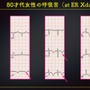 ECG-308：answer(2/2)