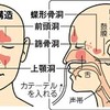 鼻炎からの感染症　急性鼻副鼻腔炎