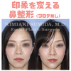 肋軟骨を使った鼻中隔延長①