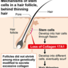 薄毛、コラーゲン減が要因　東京医科歯科大が発表