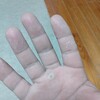 就農して最初の2週間で手のひらボロボロ
