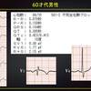 ECG-268：answer