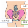 産後の腰痛の原因　その1　【仙腸関節のズレ】