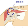 腱番断裂テストやってみて。。