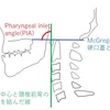 O-C固定(後頭骨-頚椎固定)と嚥下障害