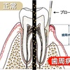 正しい歯磨きの仕方⭐️〜定番編〜