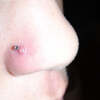 Does Alcohol Consumption Water Aid With Acne?