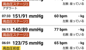 産後高血圧ブログ。産後3週目。授乳で血圧はホルモンの影響であがるらしい。上の血圧150台、下は90台