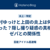 酒村ゆっけと上田の炎上は何があった？隠し撮り疑惑の真相とゼパとの関係性