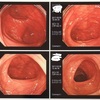 大腸検査クリア