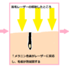 子どもが脱毛器を使ってやけどしたときの対処法