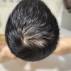 7ヵ月+26日目　7month & 26days