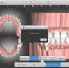 dentOneで院内アライナー作り②AI自動配列で簡単矯正セットアップできるソフトの実際