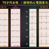 ECG-249：answer(1/2)