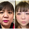 50歳からでもたるみ解消っできるの？間に合う？
