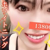 【湘南歯科】オフィスホワイトニング体験談【3回】