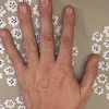 セイタカアワダチソウの煙が作る必殺技、セイタカいぶしハンド。しばらくは、爪がセイタカマニキュアになるよ。