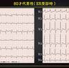 ECG-275：80才代男性。呼吸苦と血痰でした。