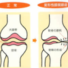 関節症にはヒアルロン酸が効くらしい。