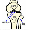 入院と手術