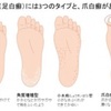 水虫、足の匂い気になる方へ