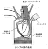 平成14年実施1級小型問題