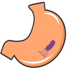 胃がんの危険性は郵送の尿検査でチェックできる