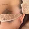 米子でうなじ脱毛なら【Beauty Salon Atete】