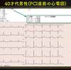 ECG-216：answer(2/2)